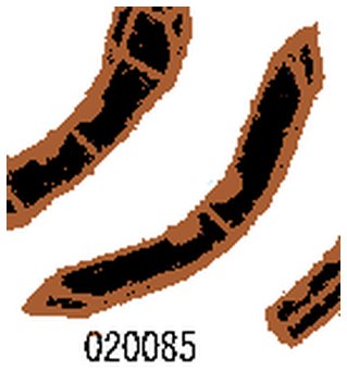 20085 — Детали глубокорыхлителей