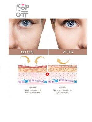 Prorance Multi Balm Anti Wrinkle - Бальзам для лица многофункциональный против морщин 10 гр