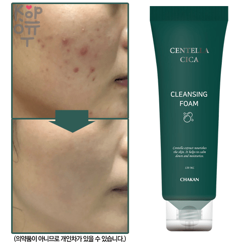 Chakan Centella Cica Cleansing Foam - Очищающая пенка с Центеллой для проблемной кожи 120мл., купить с доставкой на дом фото 1 — Корейские товары для всей семьи(КорОпт)