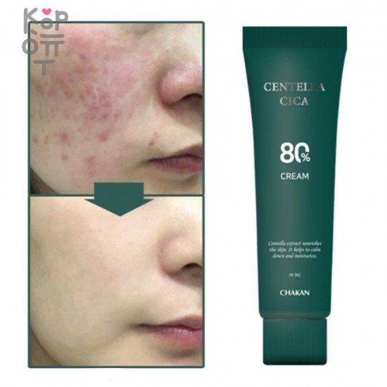 Chakan Centella Cica Cream - Успокаивающий крем для лица с экстрактом Центеллы Азиатской 50мл., купить с доставкой на дом фото 1 &mdash; Корейские товары для всей семьи(КорОпт)