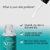Cos De Baha NZ Niacinamide 20 Zinc PCA 4 - Укрепляющая сыворотка для сужения пор, 30мл. , купить с доставкой на дом фото 3 &mdash; Корейские товары для всей семьи(КорОпт)